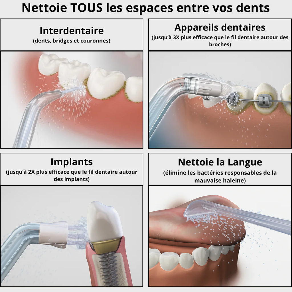 Hydropulseur Dentaire Oralveo
